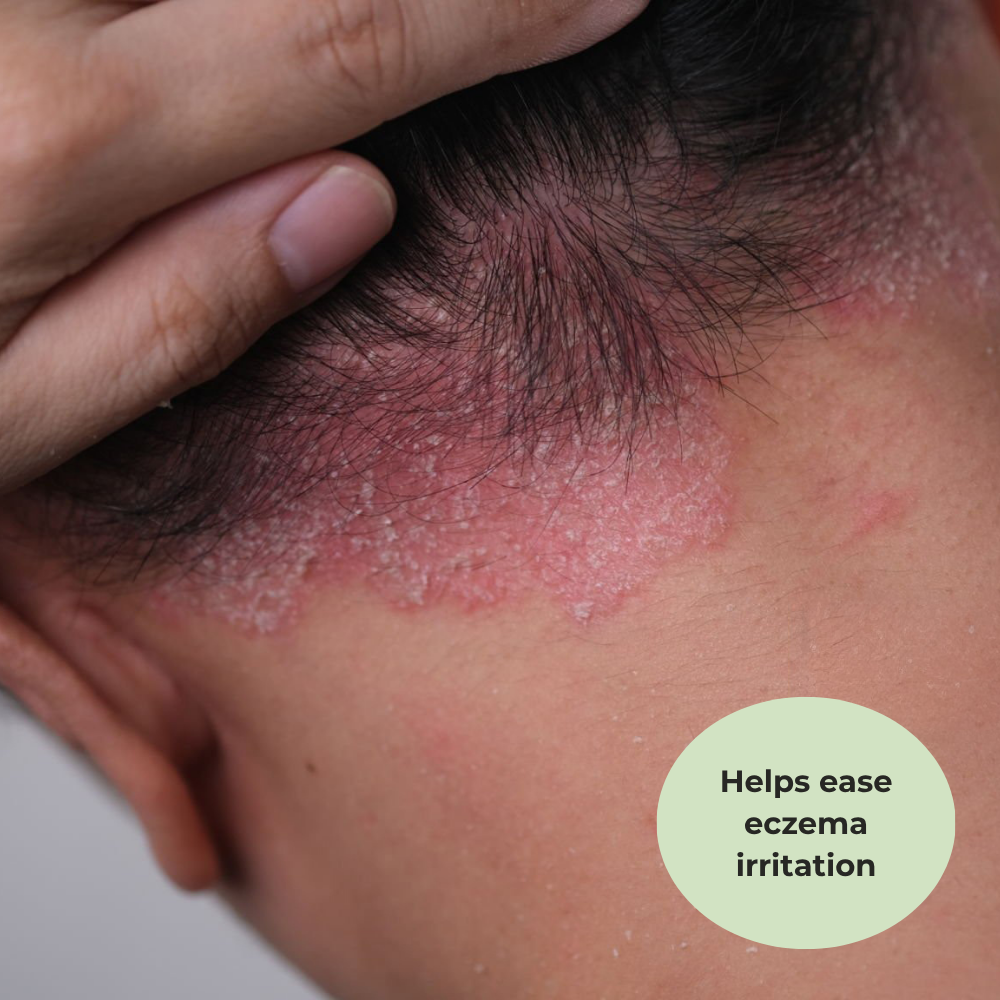 Problem Skin MSM Cream