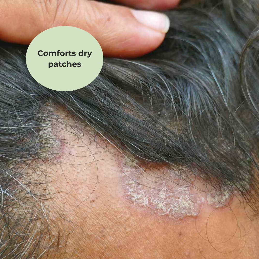 Problem Skin MSM Cream