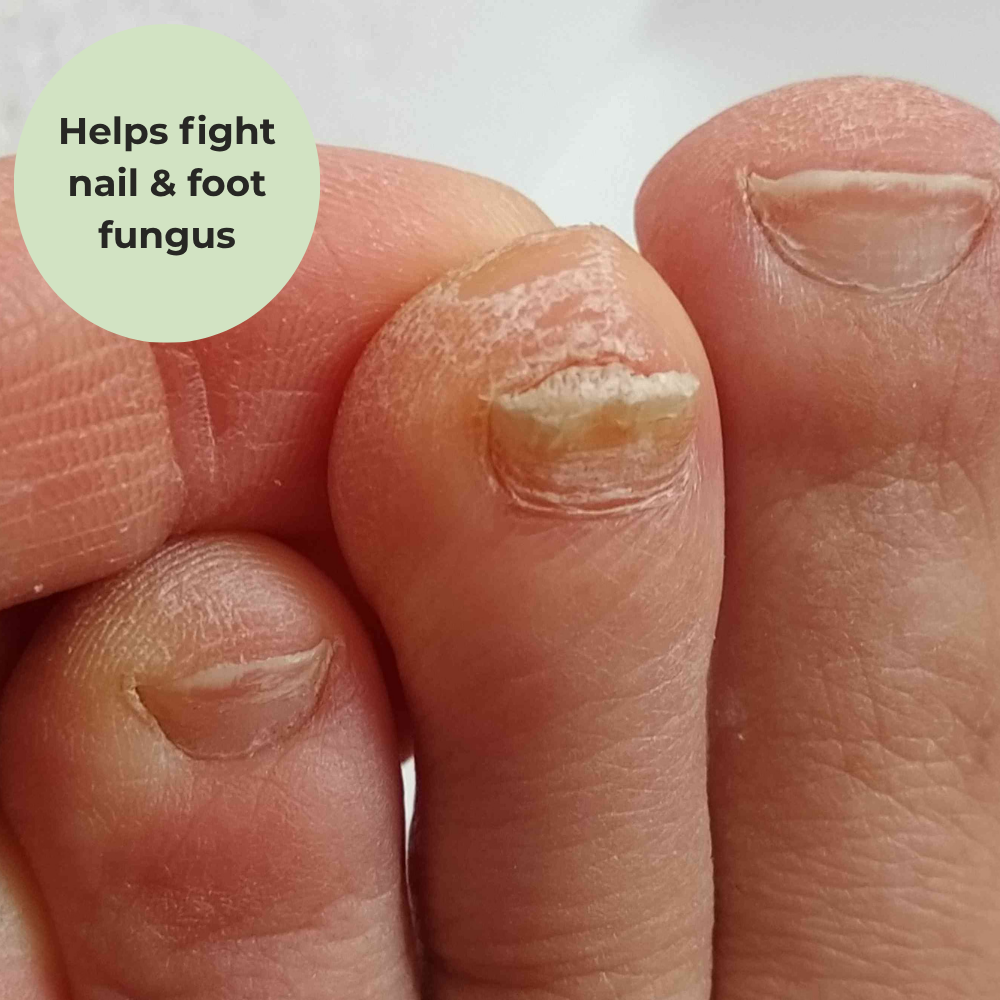 Anti-Fungal MSM with Organic Black Cumin Cream