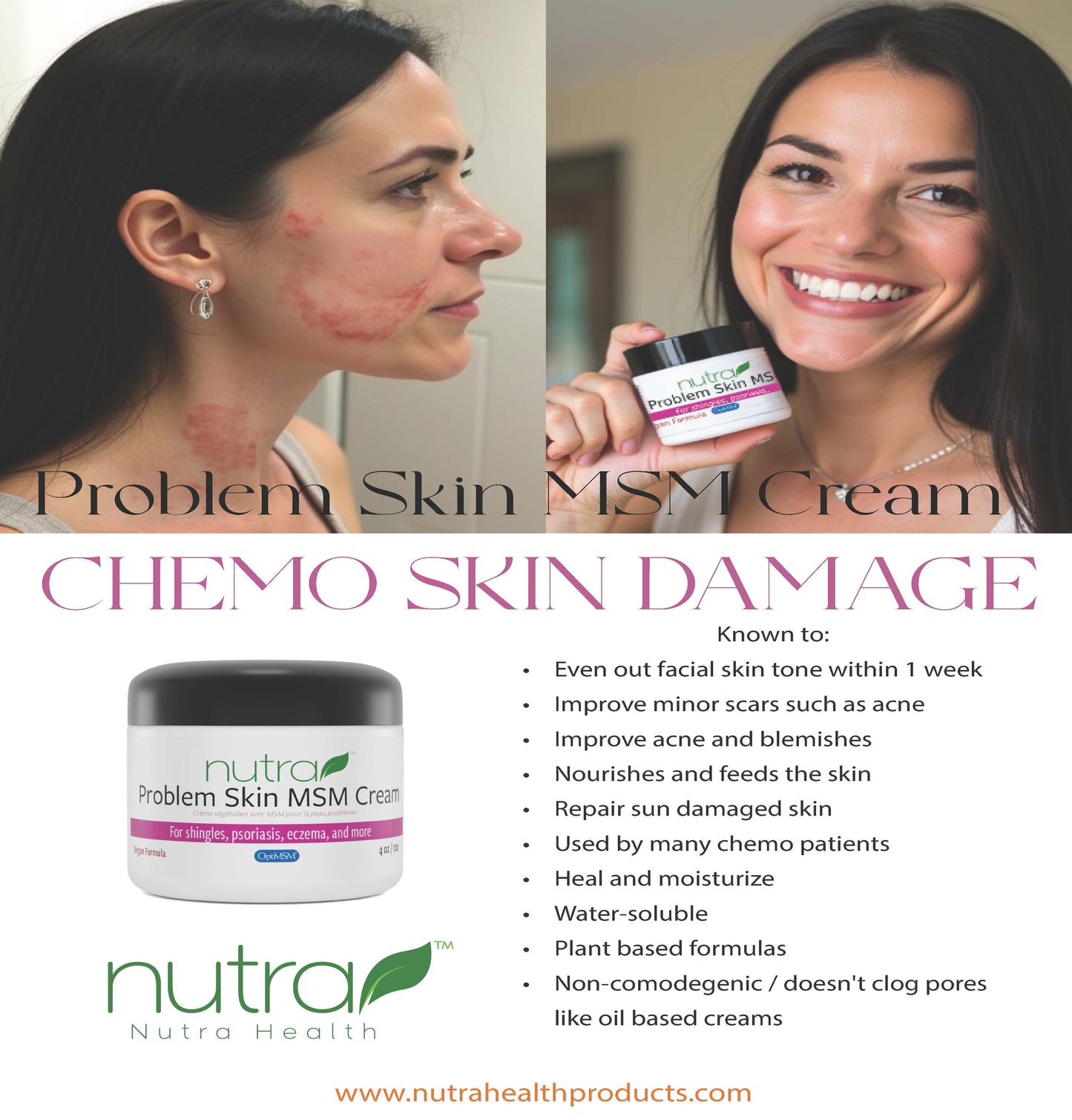 Problem Skin MSM Cream Marketing Materials