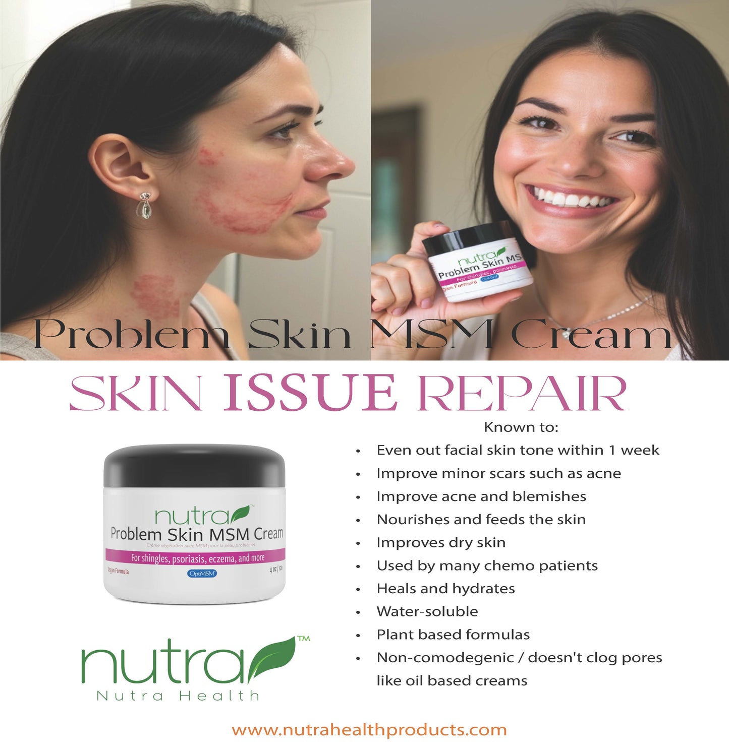 Problem Skin MSM Cream Marketing Materials