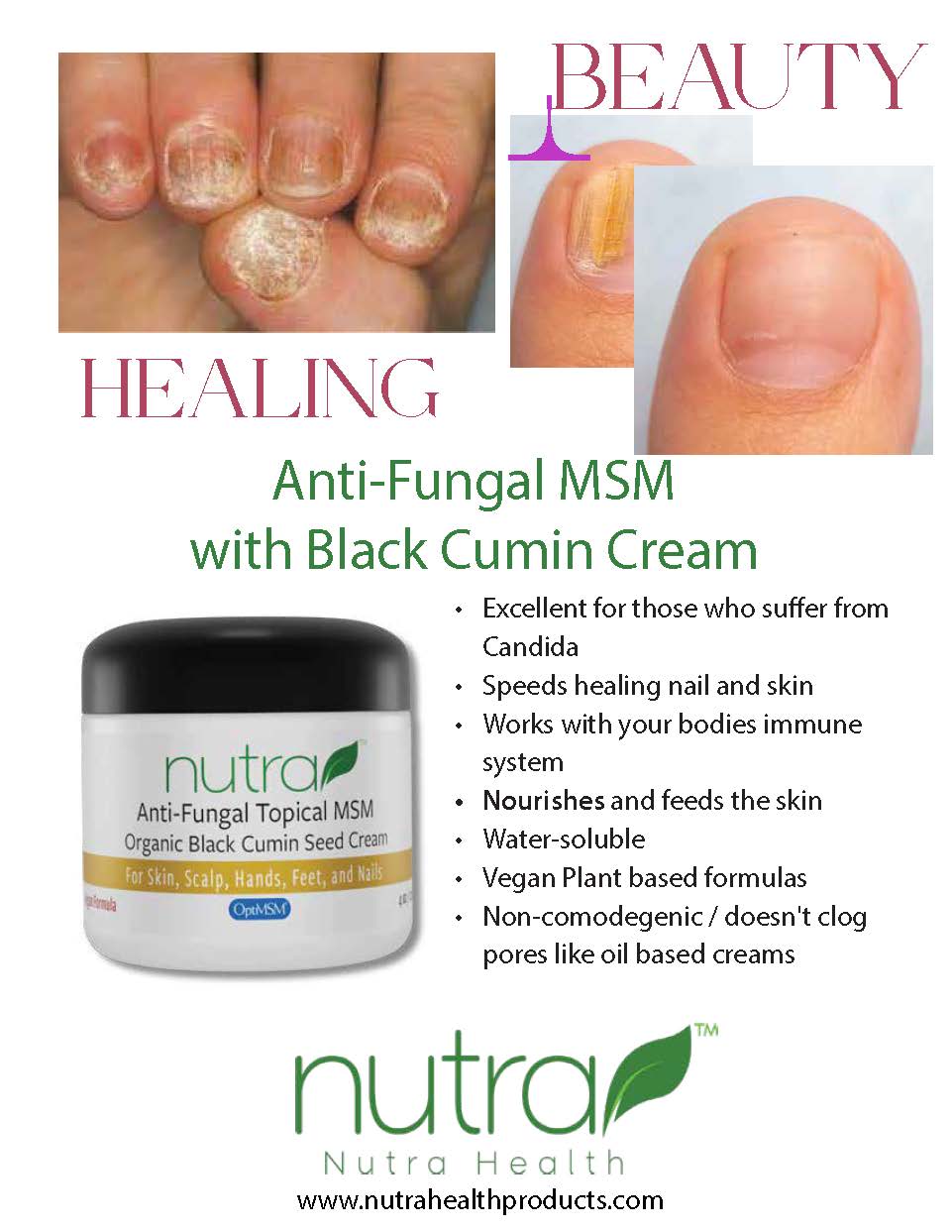 Anti-Fungal MSM with Black Cumin Cream Marketing Materials