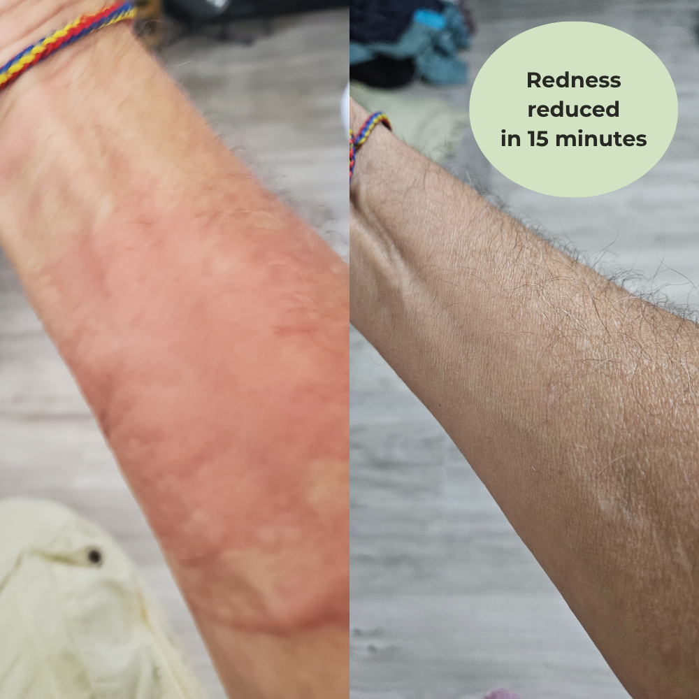 Problem Skin MSM Cream