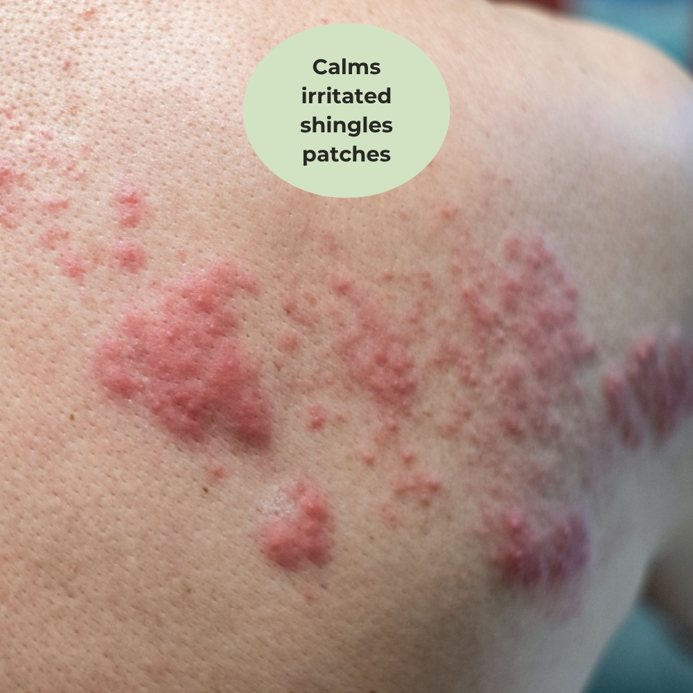 Problem Skin MSM Cream