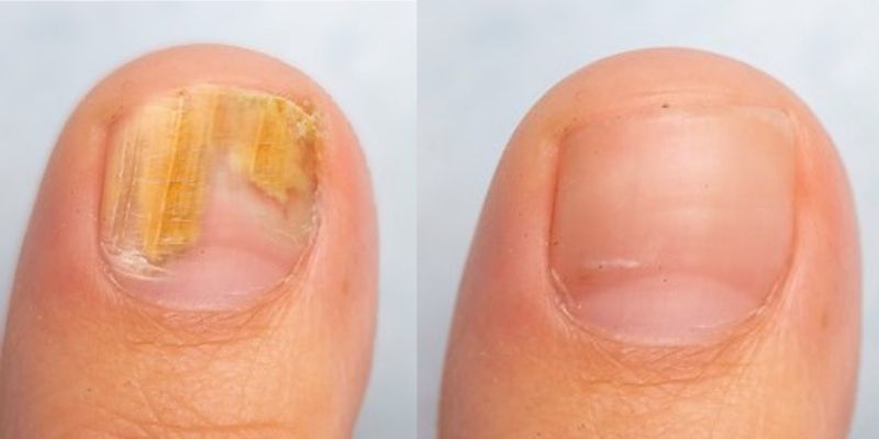 Anti-Fungal MSM with Organic Black Cumin Cream